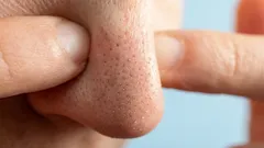 Tento problém trápi mnohých, no nie každý vie, že sa dá ľahko vyriešiť.